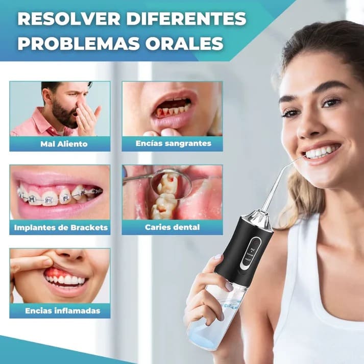 Nuevo Irrigador Bucal 🦷 Adiós al Mal Aliento y Boca Limpia de Verdad 💧
